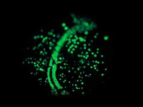 百达翡丽6104复刻-细节图9